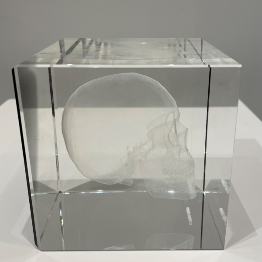 3D Skull Radiography - Picture 2 of 2
